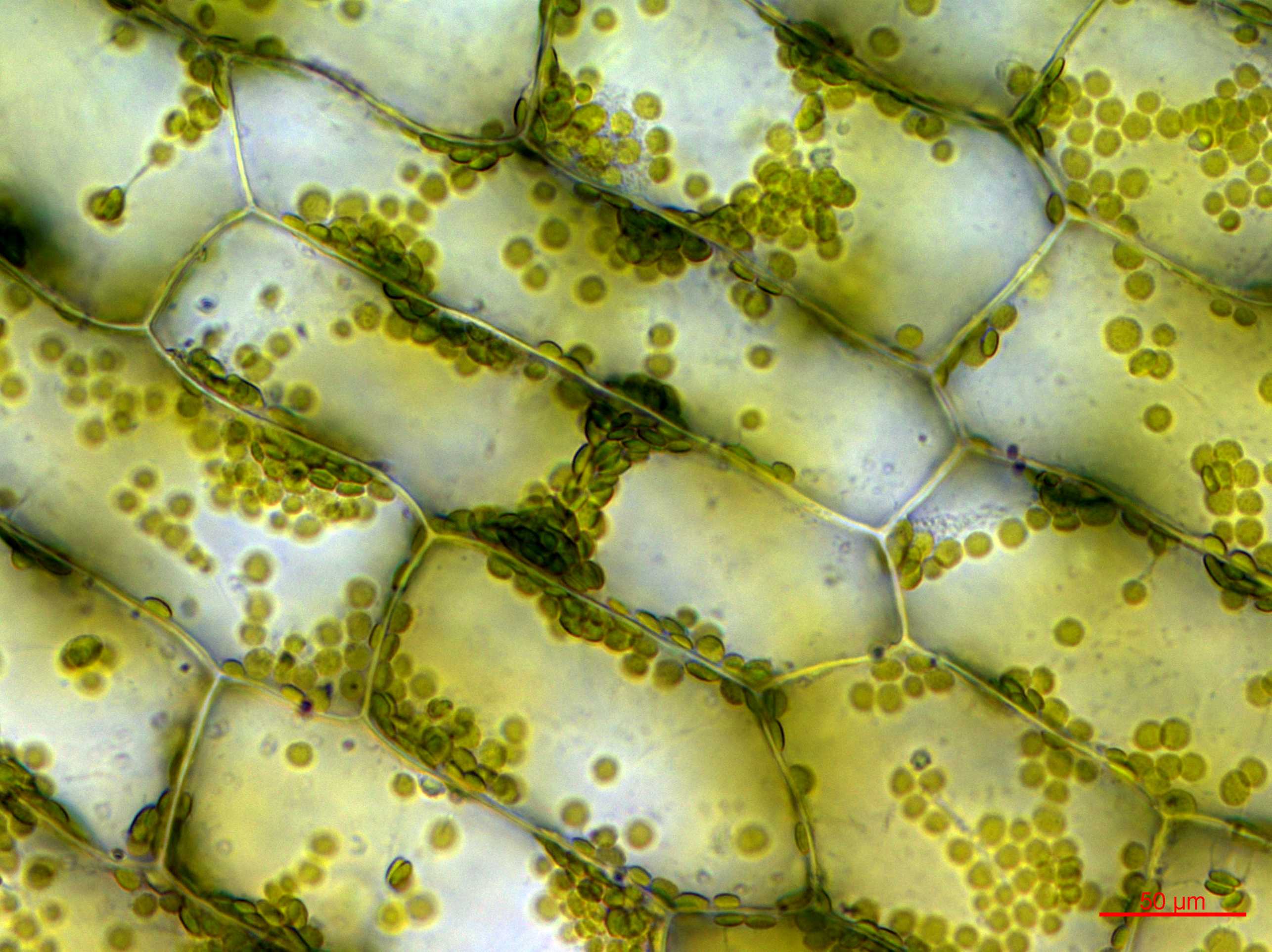 Enlarged view: Chloroplast