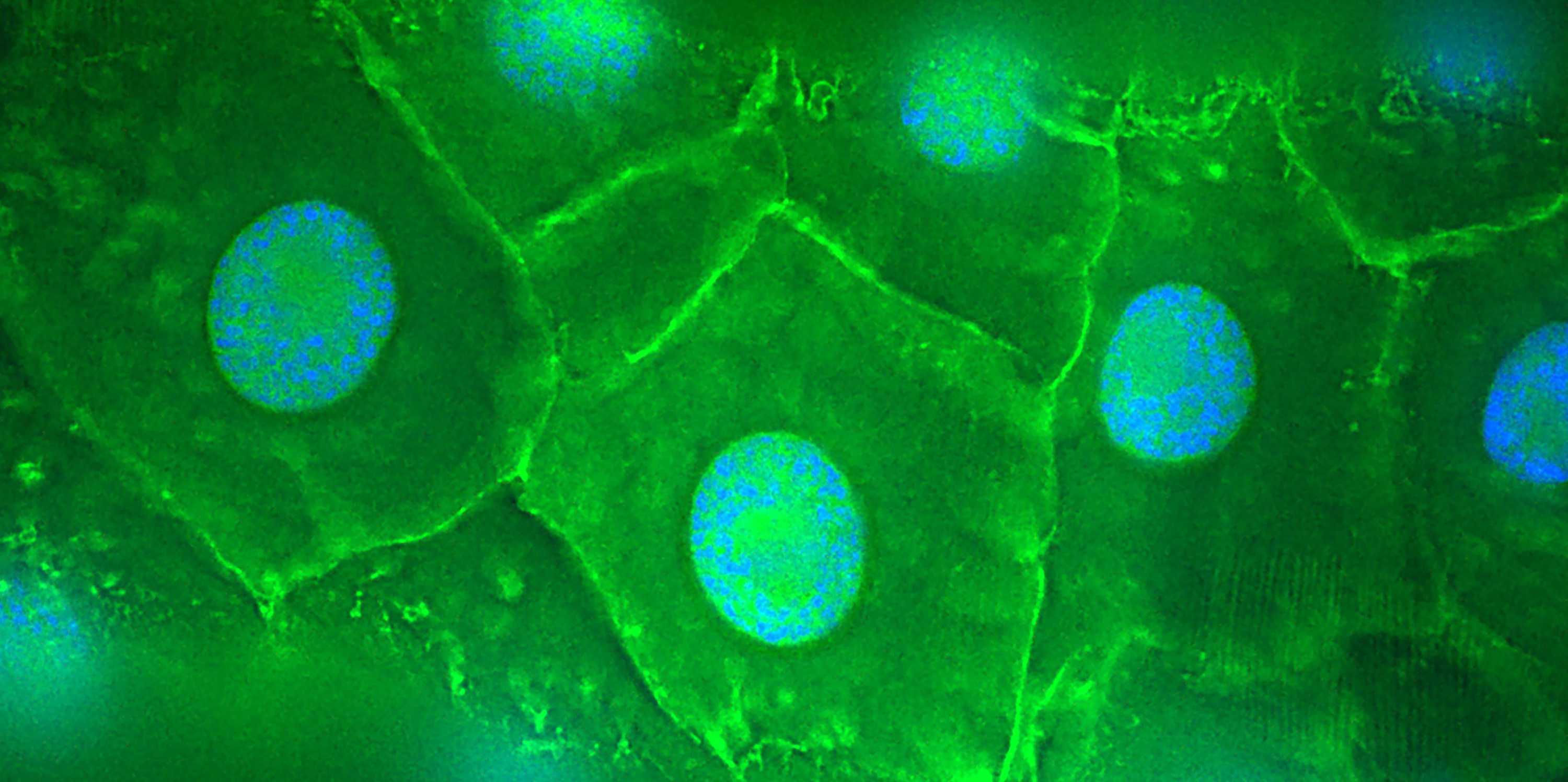 trachea-of-drosophila-scientific-center-for-optical-and-electron